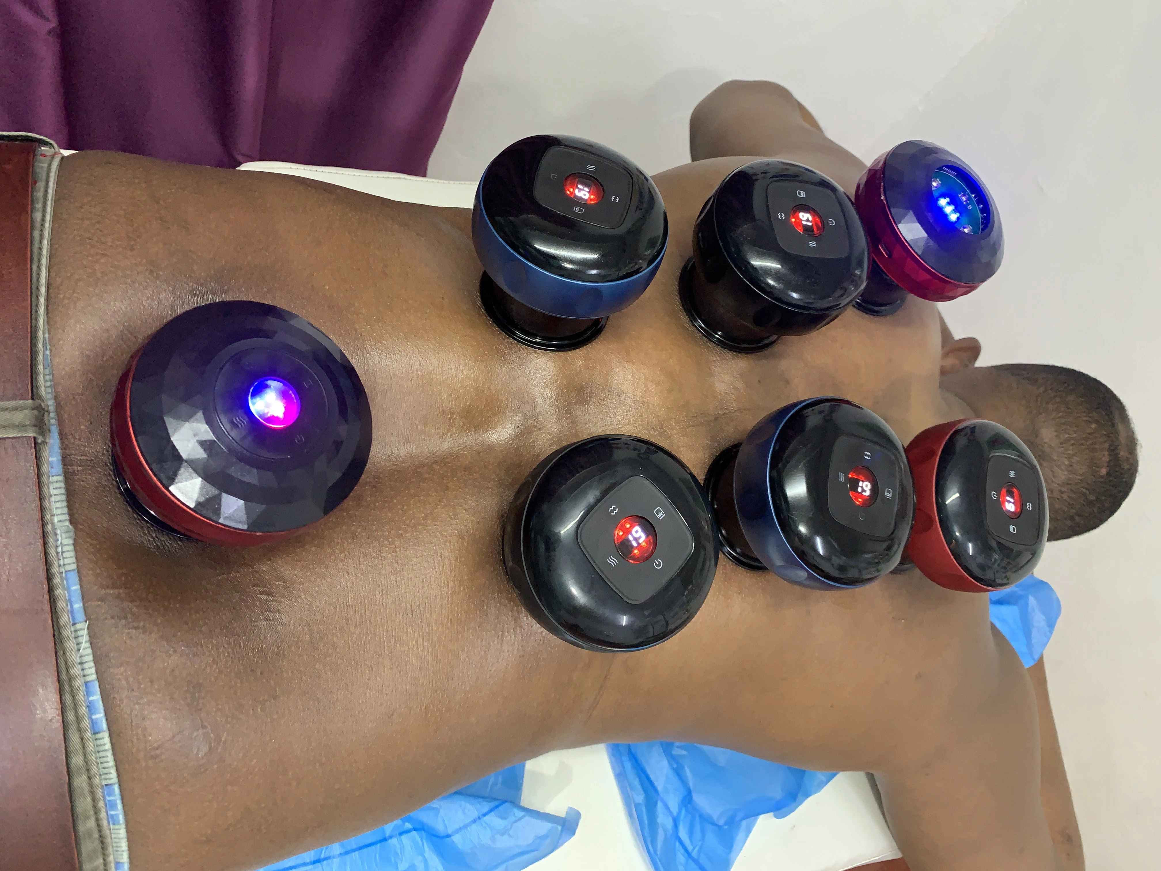 Rashid Hijama cupping Services